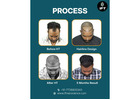 best hair transplant clinic in Jaipur